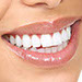 Perfectly Polished Nail Studio and Spa, Nelson BC - Teeth Whitening Nav